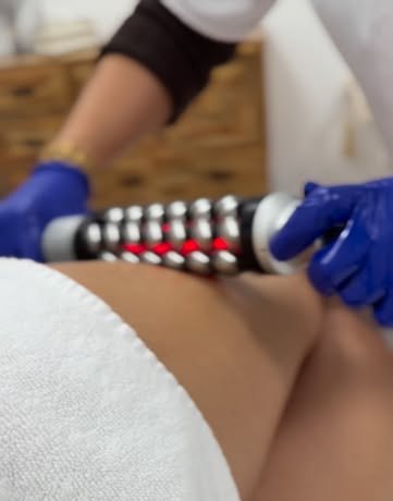 Cellulex Maderotherapie gegen Cellulite